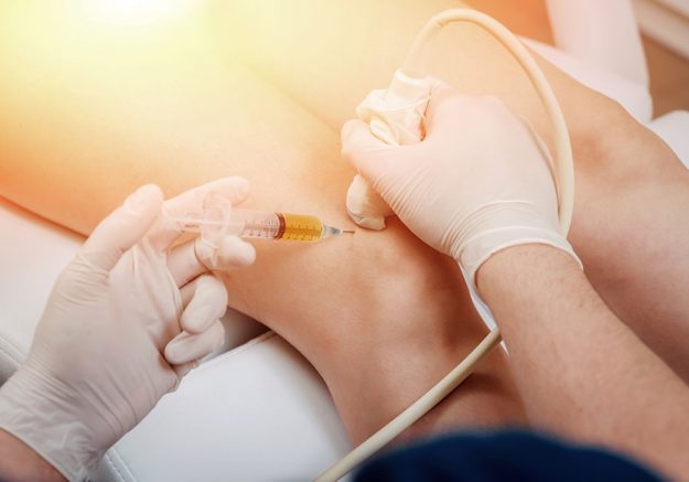 Osteoarthritis and Regenerative Medicine and regenerative medicine therapy for knee treatment Osteoarthritis and Regenerative Medicine and regenerative medicine therapy for knee treatment