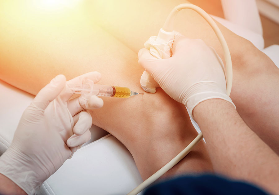 Osteoarthritis and Regenerative Medicine and regenerative medicine therapy for knee treatment