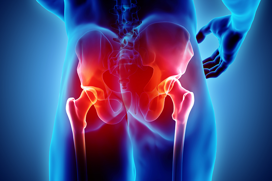 Regenerative Medicine for Hip Pain and Osteonecrosis