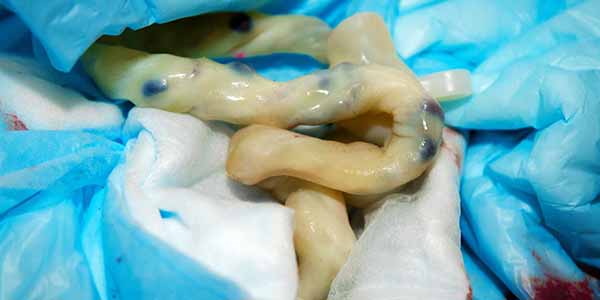 Umbilical cord blood research