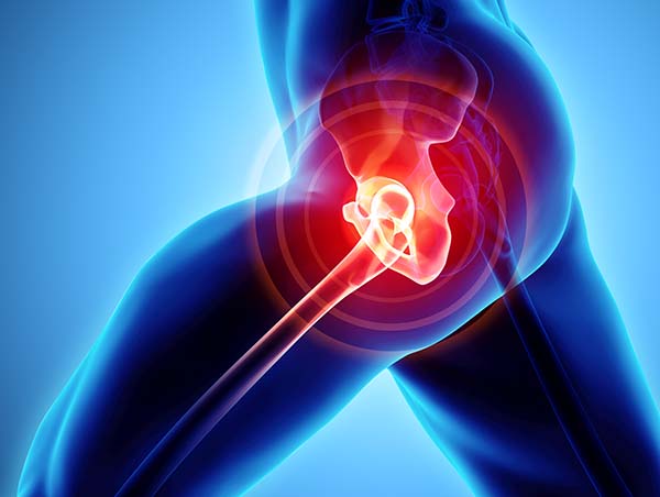 Regenerative Medicine and Platelet Rich Plasma Injectection Therapy for Hip Pain