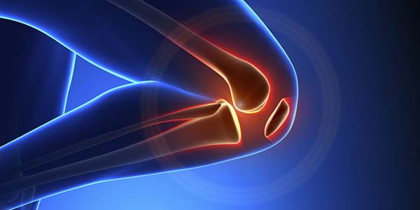 Knee Osteoarthritis Regenerative Medicines Knee Osteoarthritis Regenerative Medicines