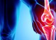 Regenerative Medicine for Treatment of Knee Osteoarthritis